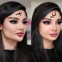 مرکز تخصصی جوانسازی اندولیفت/هایفو/لیفت فقط۸۹۰ت|خدمات آرایشگری و زیبایی|اصفهان, لاله|دیوار