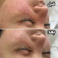 فشیال تخصصی ودرمانی|خدمات آرایشگری و زیبایی|رفسنجان, |دیوار