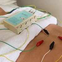 طب سوزنی، حجامت، بادکش در منزل