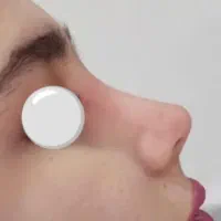 تخفیف عمل بینی نقد و چکی باشرایط فوق العاده پرداخت