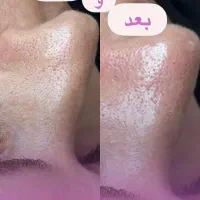 فروش کرم وماسک برندکلینیک|آرایشی، بهداشتی، درمانی|کرمان, |دیوار