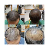 آموزش خدمات میکرواسکالپ کاشت اسکالپ مو تضمینی|خدمات آرایشگری و زیبایی|مشهد, جانباز|دیوار