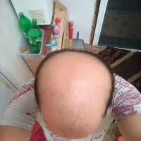 بزن پرپشت میشه