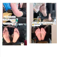 جشنواره پر تخفیف پدیکور