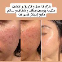 کرم سفید کننده|آرایشی، بهداشتی، درمانی|زابل, |دیوار