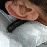 زالو 90هزار و 110هزار