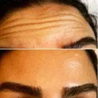 خانه ی لیزر آیدالین شهرک ارم (پوست وزیبایی )