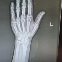 مراقبت از بیمار