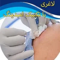 مدل امبدینگ لاغری