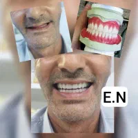 دندان سازی|خدمات آرایشگری و زیبایی|اردبیل, |دیوار