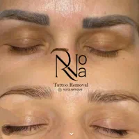 پاک کردن تتو با لیزر/ریموو ابرو/کربن تراپی(پزشک)|خدمات آرایشگری و زیبایی|مشهد, فردوسی|دیوار