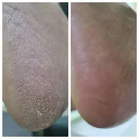پدیکور و کف سابی|خدمات آرایشگری و زیبایی|رشت, بوسار|دیوار