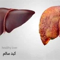 روغن کاژان خارمریم برای کبد چرب