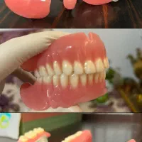 ساخت دندان مصنوعی کامل و تیکه ای با کیفیت تضمینی