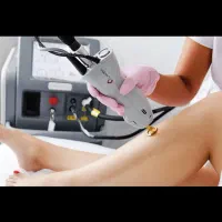 لیزر موهای زائد غیرتماسی کندلا|خدمات آرایشگری و زیبایی|دوگنبدان, |دیوار