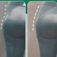 فیلربادی اقساطی رفع گودی ران،حجم دهی باسن،بیکینی