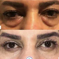 جراحی زیبایی با قیمت فوق العاده مناسب|خدمات آرایشگری و زیبایی|ساری, |دیوار