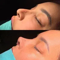 با ماهی ۲ میلیون بینی عمل کن