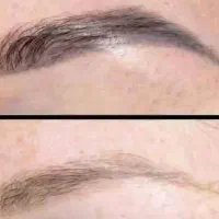 ریموو درمانی تتو های بدرنگ قدیمی|خدمات آرایشگری و زیبایی|الشتر, |دیوار