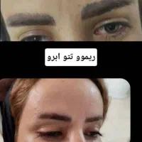 ریموو(پاک کردن)تتو ابرو چشم لب|خدمات آرایشگری و زیبایی|دوگنبدان, |دیوار
