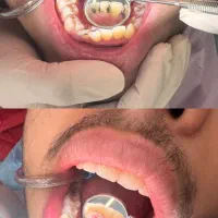 دندانپزشکی هرا ویزیت مشاوره رایگان|خدمات آرایشگری و زیبایی|اندیشه, اندیشه فاز ۳|دیوار