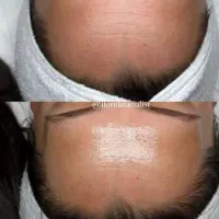 پا.کساز.ی عمقی وتخصصی فقط ۴۰۰|آرایشی، بهداشتی، درمانی|سنندج, |دیوار