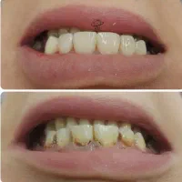 دندانپزشکی، بیمه تکمیلی و بانک، مواد عالی