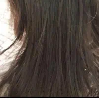 درمان شپش با ضمانت در یک جلسه