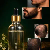 ضخامت و رویشمک و ریش