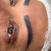 انجام فیبروز کاملا نچرال طبق عکس با مناسبترین قیمت