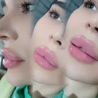 بمب تخفیف خدمات زیبایی ژل بوتاکس جوانساز بادی