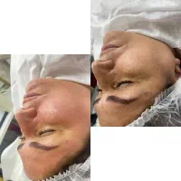 ارائه خدمات پوستی در محله تسلیحات از ۶۰۰ هزارتومان|خدمات زیبایی و سلامت|تهران, تسلیحات|دیوار