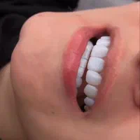 کامپوزیت ونیر|خدمات آرایشگری و زیبایی|شهریار, شهرک وائین|دیوار