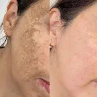 کرم وی ای پی اصل صدرصد تضمینی و بدون بازگشت|آرایشی، بهداشتی، درمانی|یاسوج, |دیوار