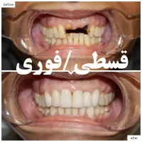 دندانپزشک قسطی بدون پیش پرداخت کلیه خدمات|خدمات آرایشگری و زیبایی|اصفهان, دشتستان|دیوار