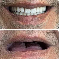 لابراتوار دندانسازی سبز|پزشکی|نسیمشهر, |دیوار