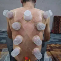 حجامت ، بادکش درمانی، مزاج شناسی|خدمات آرایشگری و زیبایی|اهواز, زیتون کارگری|دیوار
