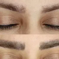 ریموو ابرو و انواع تتو با لیزر بدون هیچ زخمی