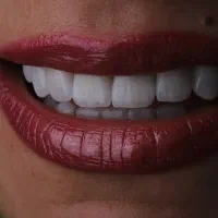 دستیار دندانپزشکی