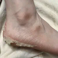 بیماری های ناخن تیرگی قوزک پدیکور آقایان و خانم ها|خدمات آرایشگری و زیبایی|زنجان, |دیوار