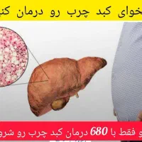 مشکلات کبدچرب