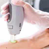 استخدام اپراتور لیزر خانم