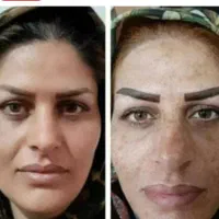 محصولات برندضد لک  ضد چروک  ضد آفتاب و آبرسان قوی|آرایشی، بهداشتی، درمانی|اصفهان, شاهزید|دیوار