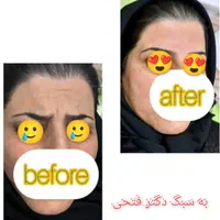 انجام کلیه خدمات زیبایی توسط پزشک در کلینیک در فسا