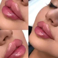 پوست و مو و لیزر