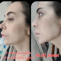 جشنواره تزریق فیلر و ژل و بوتاکس در قلب پزشکی مشهد|خدمات آرایشگری و زیبایی|مشهد, احمدآباد|دیوار