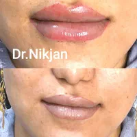 تخفیف ویژه افتتاحیه کلینیک زیبایی دکتر نیک جان|خدمات آرایشگری و زیبایی|رشت, گلسار|دیوار