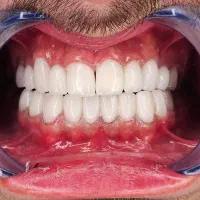 دندانپزشکی|خدمات آرایشگری و زیبایی|ارومیه, |دیوار