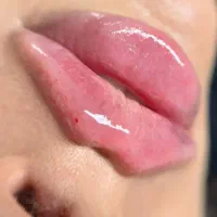 دوره ژل وبوتاکس نخ فیلربادی|خدمات آموزشی|تهران, جمهوری|دیوار