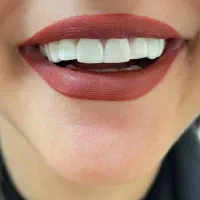 دندانپزشکی اطفال و بزرگسال|خدمات آرایشگری و زیبایی|رشت, پل تالشان|دیوار